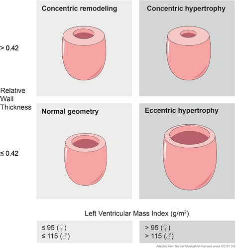 concentric lv hypertrophy treatment|eccentric vs concentric hypertrophy heart.